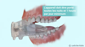 Éducateur fonctionnel – Concept d’intervention et de prévention